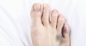 foot pain bruise