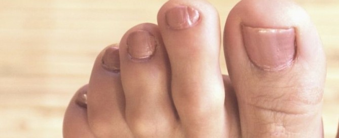 weird pinky toenail